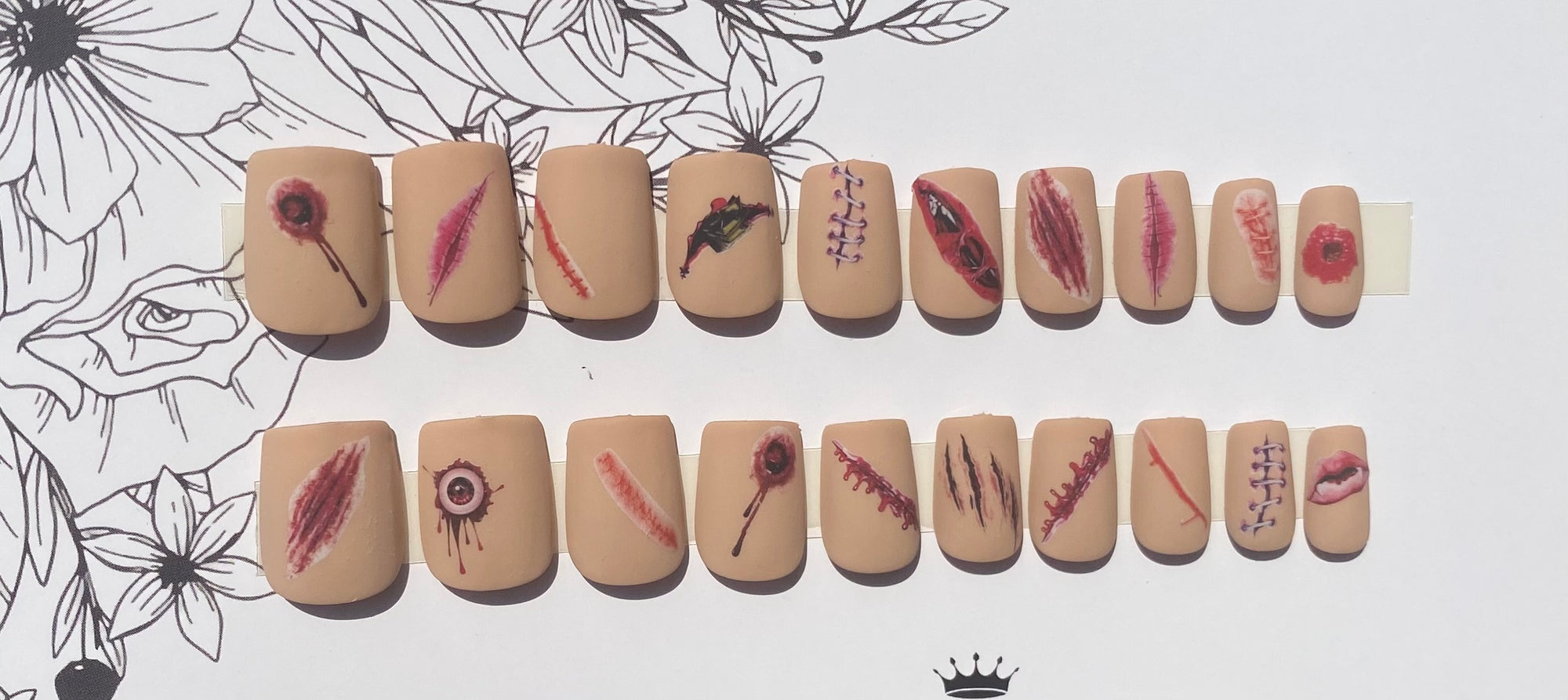 Wounds